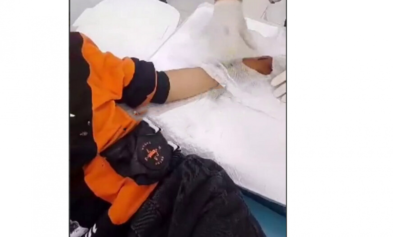حمله‌ی دانش‌ آموز افغانی با چاقو به دانش آموز ایرانی و مجروح کردن او+ فیلم